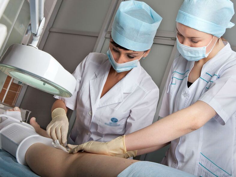 Laserablation bei Krampfadern